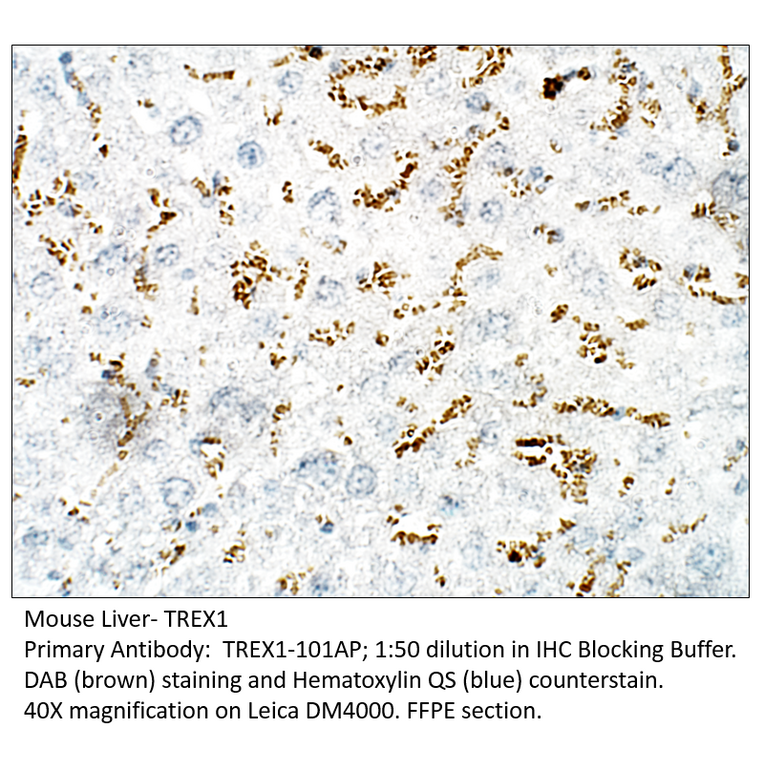 Anti-TREX1 Antibody from FabGennix (TREX1-101AP) - Antibodies.com