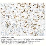 Anti-TREX1 Antibody from FabGennix (TREX1-101AP) - Antibodies.com