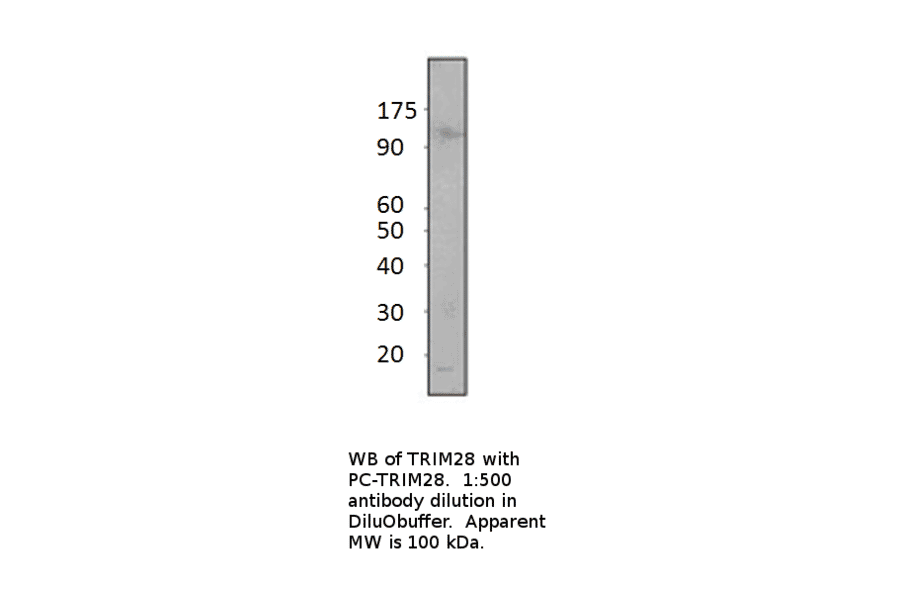 Anti-KAP1 Antibody from FabGennix (TRIM28-101AP) - Antibodies.com