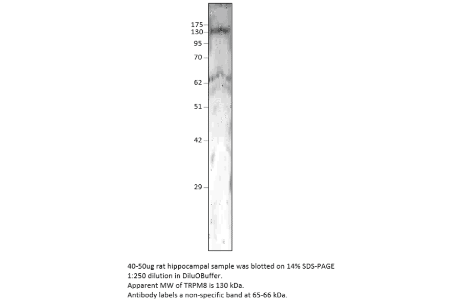 Anti-TRPM8 Antibody from FabGennix (TRPM8-101AP) - Antibodies.com