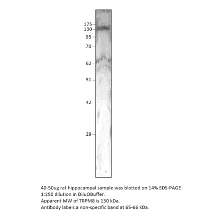 Anti-TRPM8 Antibody from FabGennix (TRPM8-101AP) - Antibodies.com