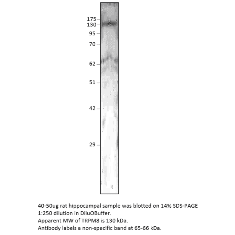 Anti-TRPM8 Antibody from FabGennix (TRPM8-101AP) - Antibodies.com