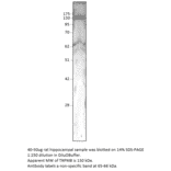 Anti-TRPM8 Antibody from FabGennix (TRPM8-101AP) - Antibodies.com