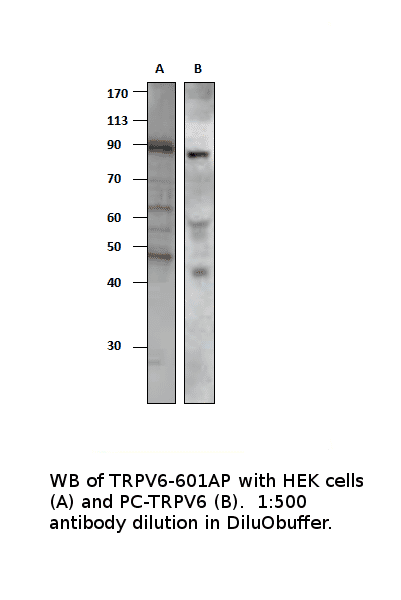 Anti-TRPV6 Antibody