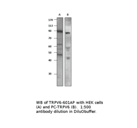 Anti-TRPV6 Antibody from FabGennix (TRPV6-601AP) - Antibodies.com