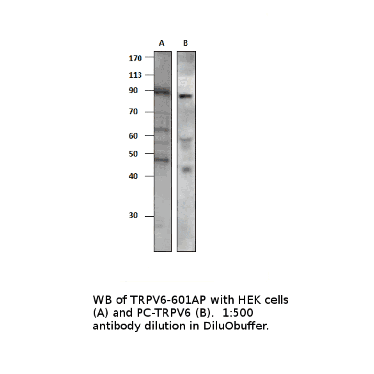 Anti-TRPV6 Antibody from FabGennix (TRPV6-601AP) - Antibodies.com