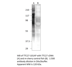 Anti-TTC27 Antibody from FabGennix (TTC27-101AP) - Antibodies.com