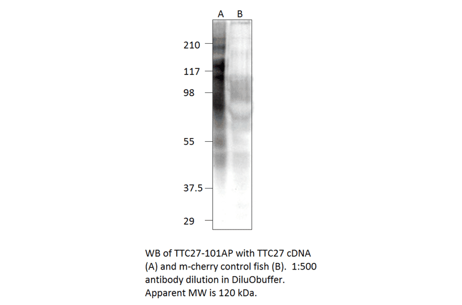 Anti-TTC27 Antibody from FabGennix (TTC27-101AP) - Antibodies.com