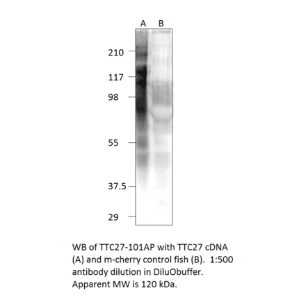 Anti-TTC27 Antibody from FabGennix (TTC27-101AP) - Antibodies.com