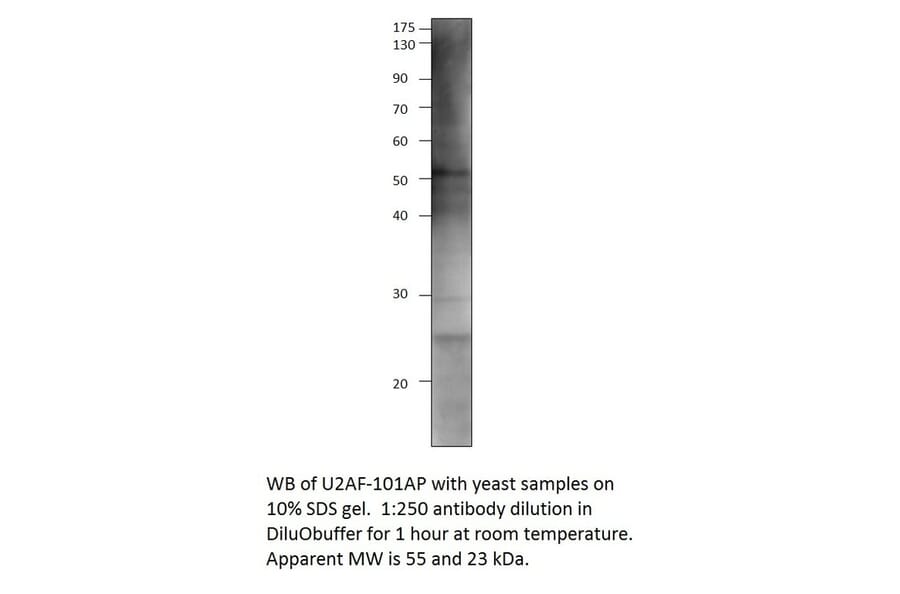 Anti-U2AF59 Antibody from FabGennix (U2AF-101AP) - Antibodies.com