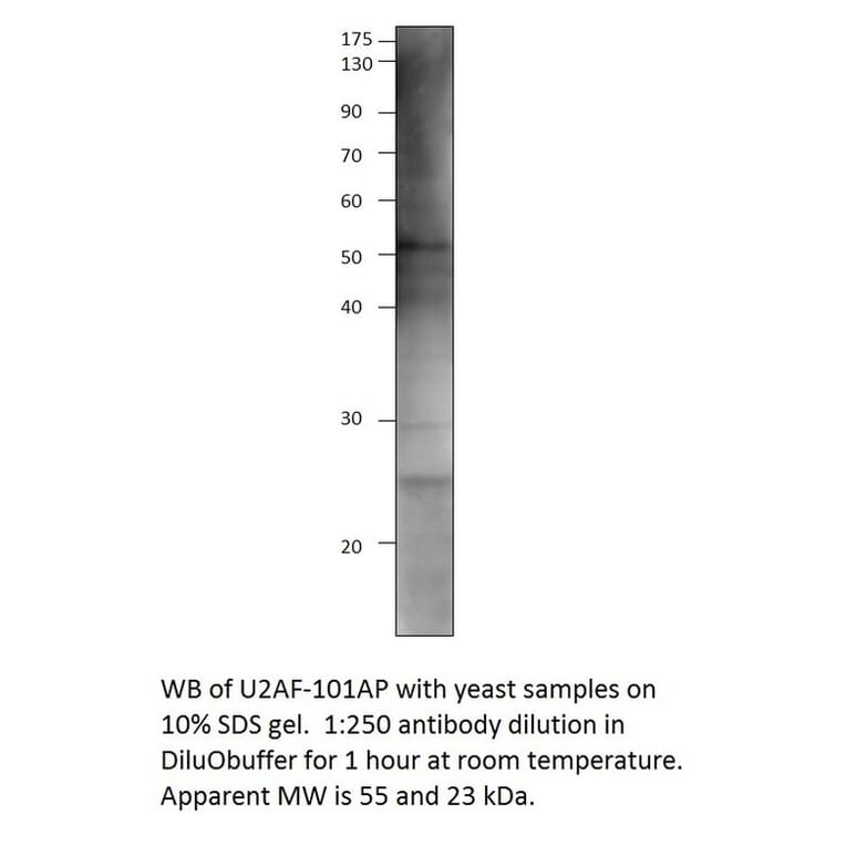 Anti-U2AF59 Antibody from FabGennix (U2AF-101AP) - Antibodies.com