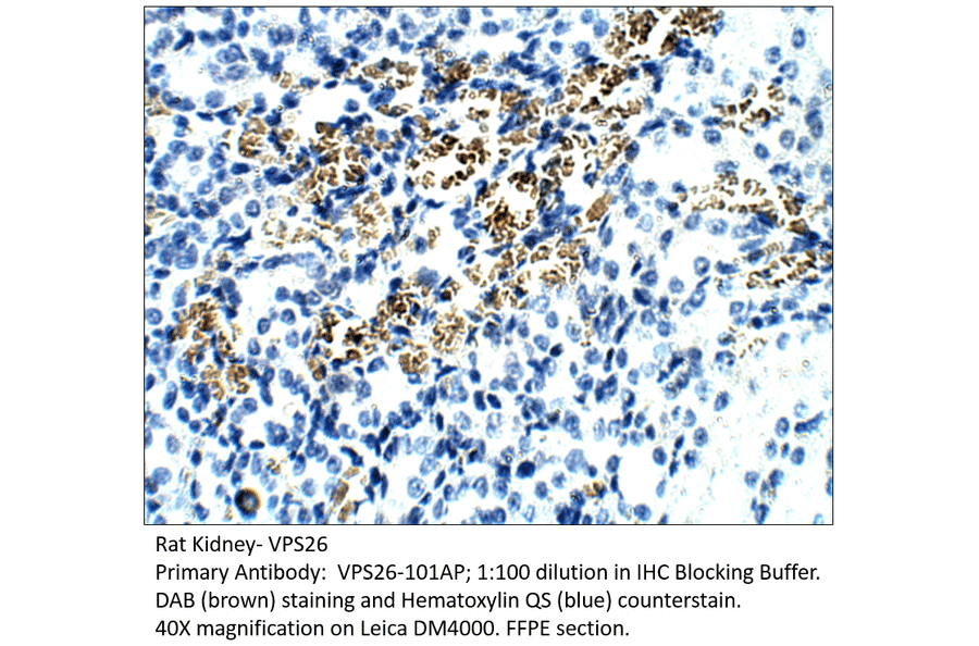 Anti-VPS26 Antibody from FabGennix (VPS26-101AP) - Antibodies.com