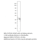 Anti-VPS26 Antibody from FabGennix (VPS26-101AP) - Antibodies.com