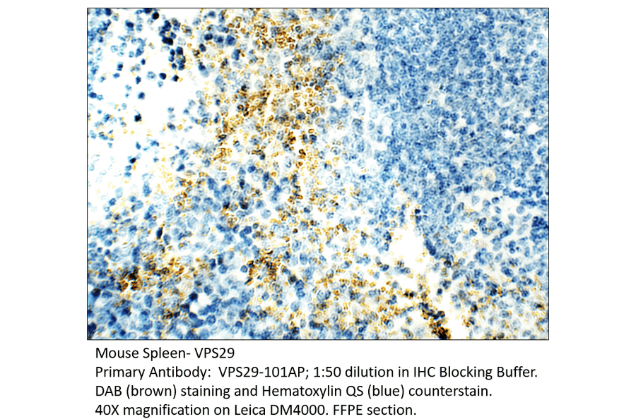Anti-VPS29 Antibody from FabGennix (VPS29-101AP) - Antibodies.com