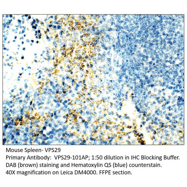 Anti-VPS29 Antibody from FabGennix (VPS29-101AP) - Antibodies.com