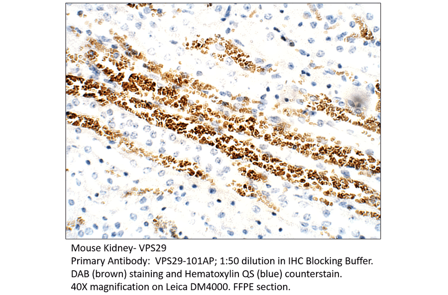Anti-VPS29 Antibody from FabGennix (VPS29-101AP) - Antibodies.com