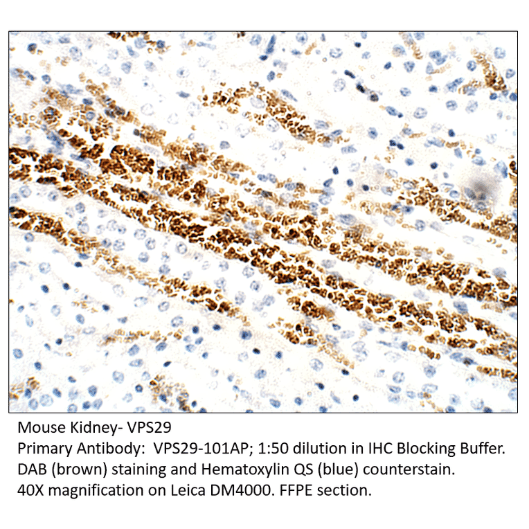 Anti-VPS29 Antibody from FabGennix (VPS29-101AP) - Antibodies.com