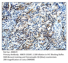 Anti-AMACR Antibody from FabGennix (AMCR-101AP) - Antibodies.com