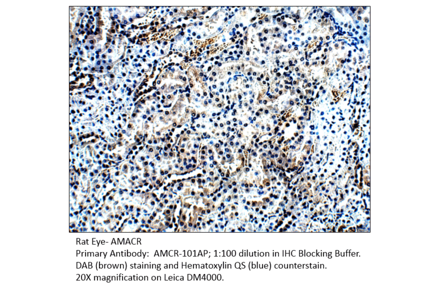 Anti-AMACR Antibody from FabGennix (AMCR-101AP) - Antibodies.com