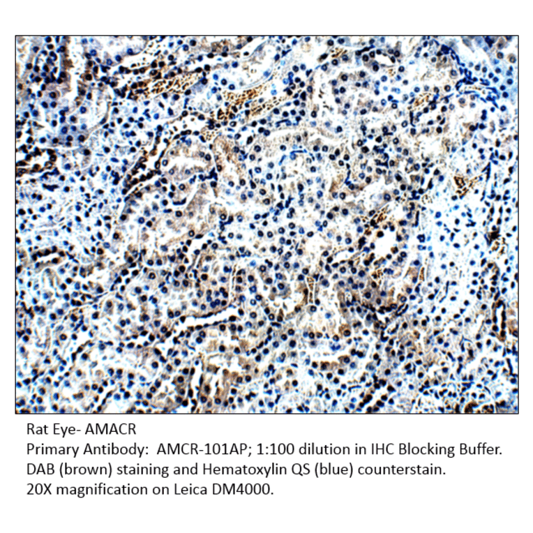 Anti-AMACR Antibody from FabGennix (AMCR-101AP) - Antibodies.com