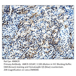 Anti-AMACR Antibody from FabGennix (AMCR-101AP) - Antibodies.com