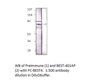 Anti-BEST4 Antibody from FabGennix (BEST-401AP) - Antibodies.com