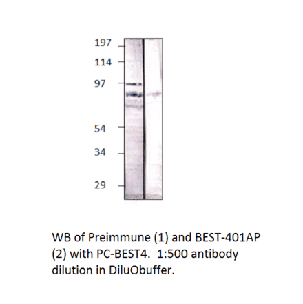 Anti-BEST4 Antibody from FabGennix (BEST-401AP) - Antibodies.com