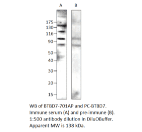 Anti-BTBD7 Antibody from FabGennix (BTBD-701AP) - Antibodies.com