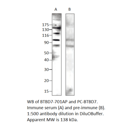 Anti-BTBD7 Antibody from FabGennix (BTBD-701AP) - Antibodies.com