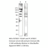 Anti-BTBD7 Antibody from FabGennix (BTBD-701AP) - Antibodies.com