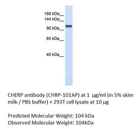 Anti-CHERP Antibody from FabGennix (CHRP-101AP) - Antibodies.com