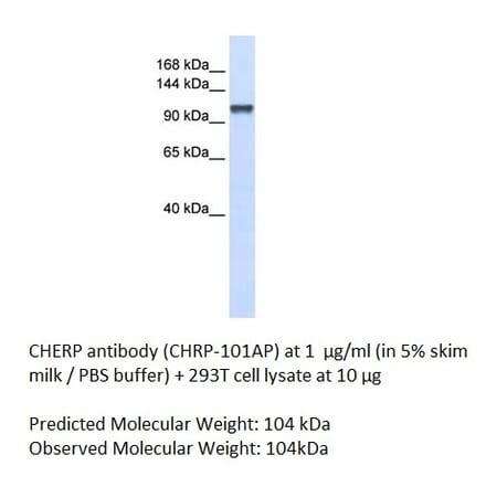 Anti-CHERP Antibody from FabGennix (CHRP-101AP) - Antibodies.com