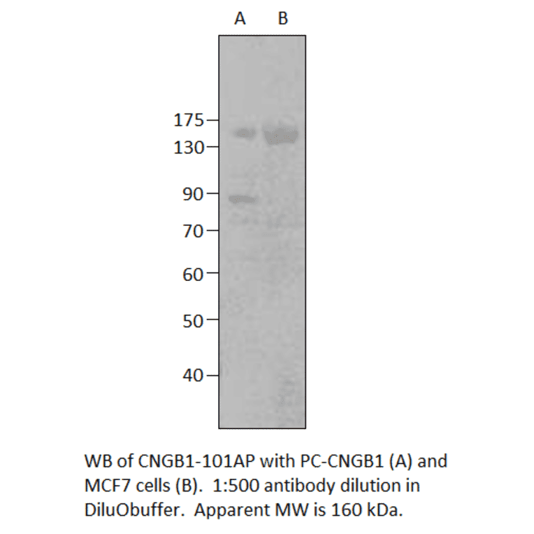 Anti-GARP Antibody from FabGennix (CNGB1-101AP) - Antibodies.com