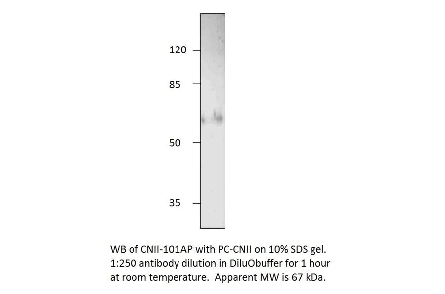 Anti-NT5C2 Antibody from FabGennix (CNII-101AP) - Antibodies.com