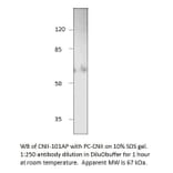 Anti-NT5C2 Antibody from FabGennix (CNII-101AP) - Antibodies.com