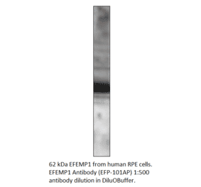 Anti-EFEMP1 Antibody from FabGennix (EFP-101AP) - Antibodies.com