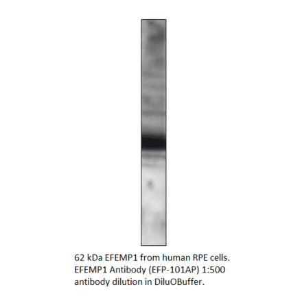 Anti-EFEMP1 Antibody from FabGennix (EFP-101AP) - Antibodies.com