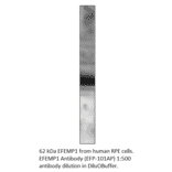 Anti-EFEMP1 Antibody from FabGennix (EFP-101AP) - Antibodies.com