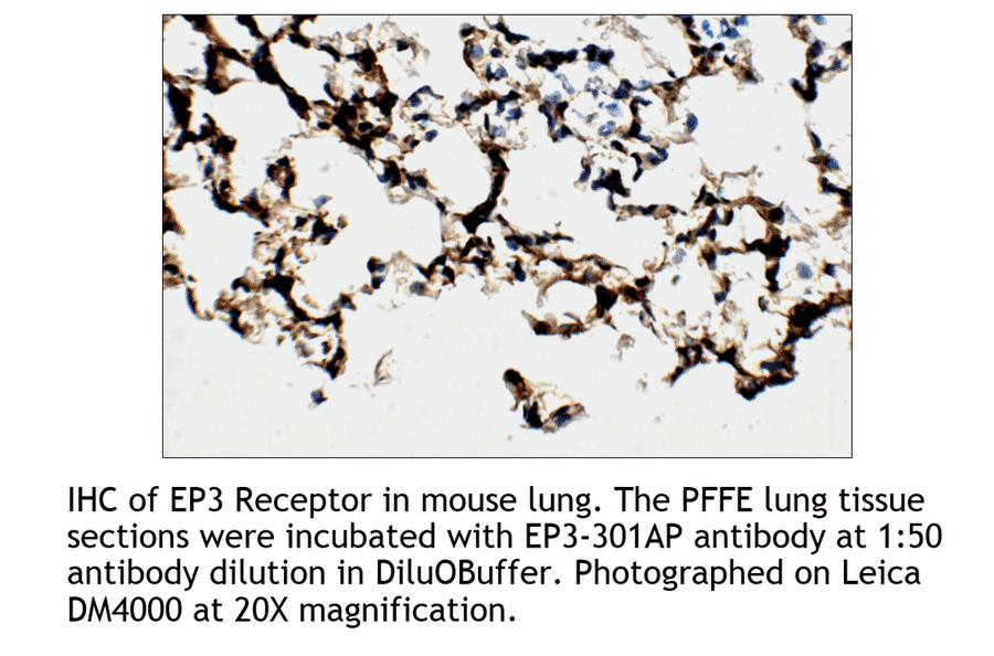 Anti-PTGER3 Antibody from FabGennix (EP3-301AP) - Antibodies.com