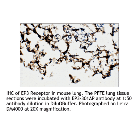 Anti-PTGER3 Antibody from FabGennix (EP3-301AP) - Antibodies.com