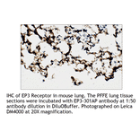 Anti-PTGER3 Antibody from FabGennix (EP3-301AP) - Antibodies.com