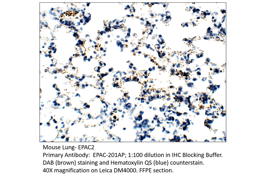 Anti-EPAC2 Antibody from FabGennix (EPAC-201AP) - Antibodies.com