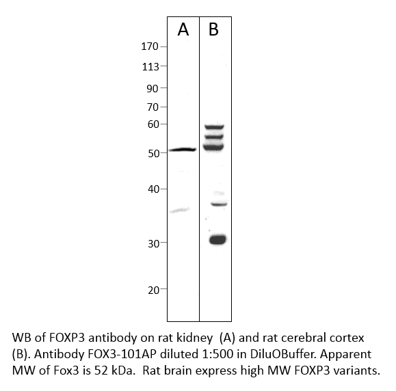 Anti-FOXP3 Antibody (A54842) | Antibodies.com