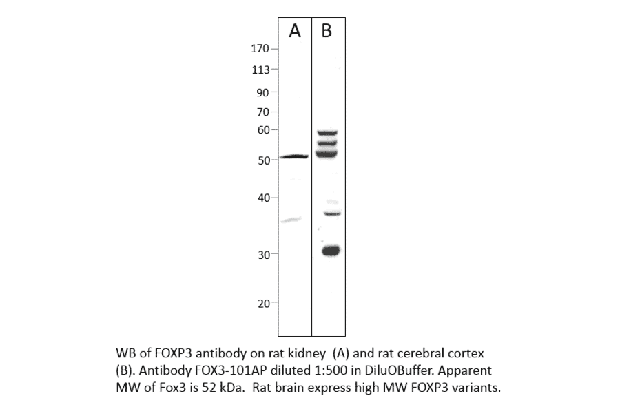 Anti-FOXP3 Antibody from FabGennix (FOX3-101AP) - Antibodies.com