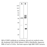 Anti-FOXP3 Antibody from FabGennix (FOX3-101AP) - Antibodies.com