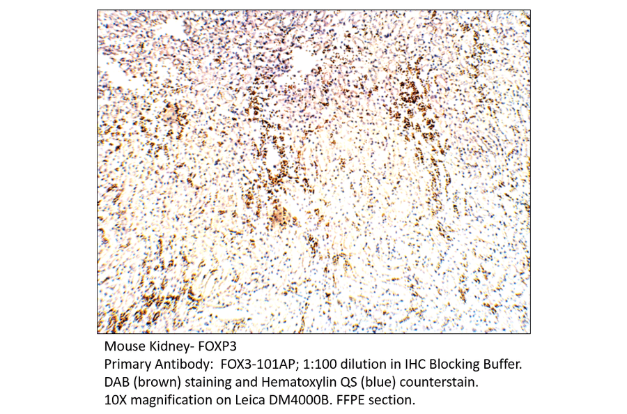 Anti-FOXP3 Antibody from FabGennix (FOX3-101AP) - Antibodies.com