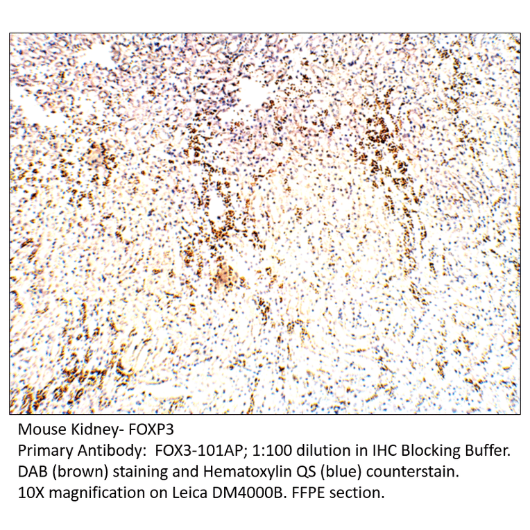 Anti-FOXP3 Antibody from FabGennix (FOX3-101AP) - Antibodies.com