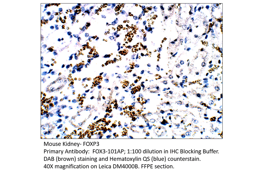 Anti-FOXP3 Antibody from FabGennix (FOX3-101AP) - Antibodies.com