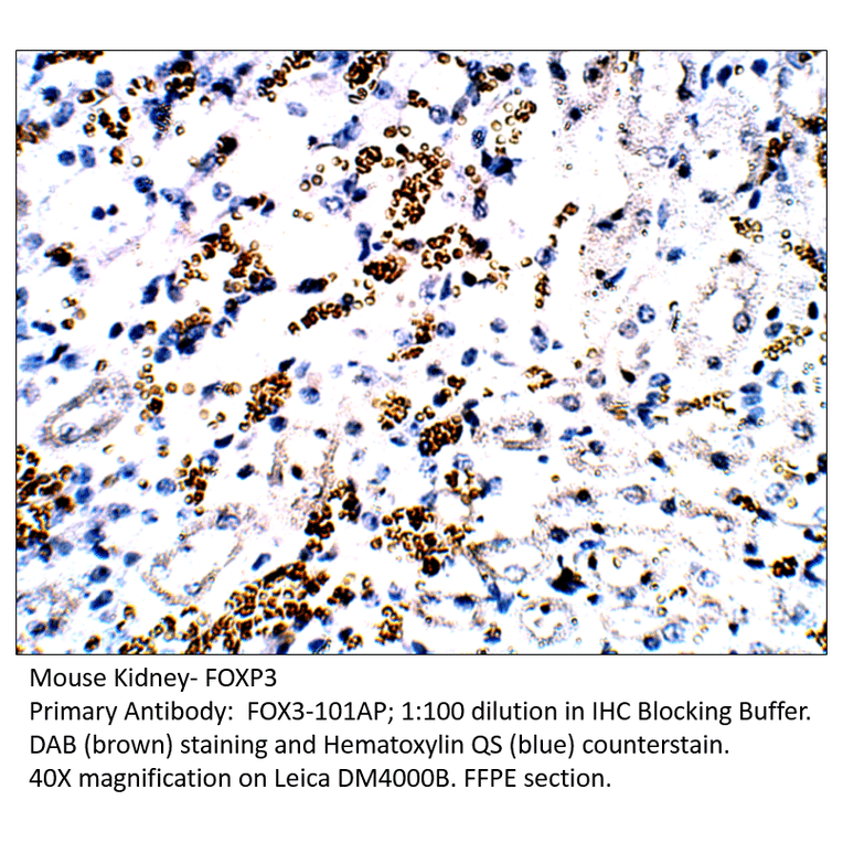 Anti-FOXP3 Antibody from FabGennix (FOX3-101AP) - Antibodies.com