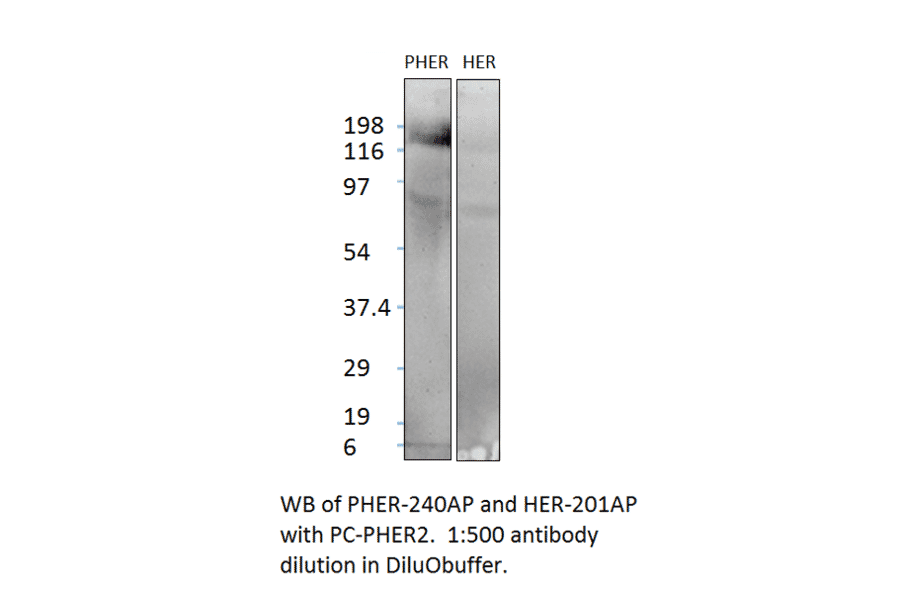 Anti-ErbB 2 Antibody from FabGennix (HER-201AP) - Antibodies.com